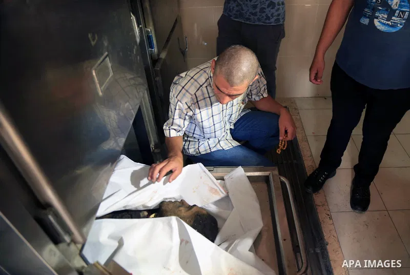 The body of Palestinian, who was killed in an unexplained explosion is seen at Indonesian hospital, in the northern of Gaza Strip on July 29, 2018. Photo by Dawoud Abo Alkas