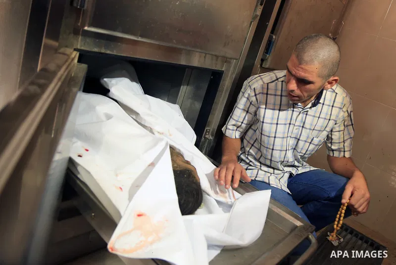 The body of Palestinian, who was killed in an unexplained explosion is seen at Indonesian hospital, in the northern of Gaza Strip on July 29, 2018. Photo by Dawoud Abo Alkas