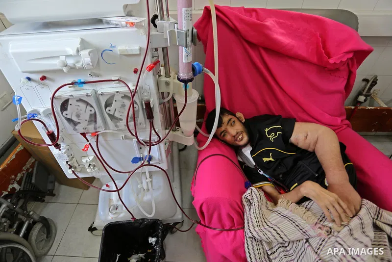 A Palestinian patient undergoes kidney dialysis at al-Shifa hospital during the continuing crisis of power outages, in Gaza city on August 28, 2018. The spokesman of Gaza’s Health Ministry, Ashraf Al-Qudra said on Monday...