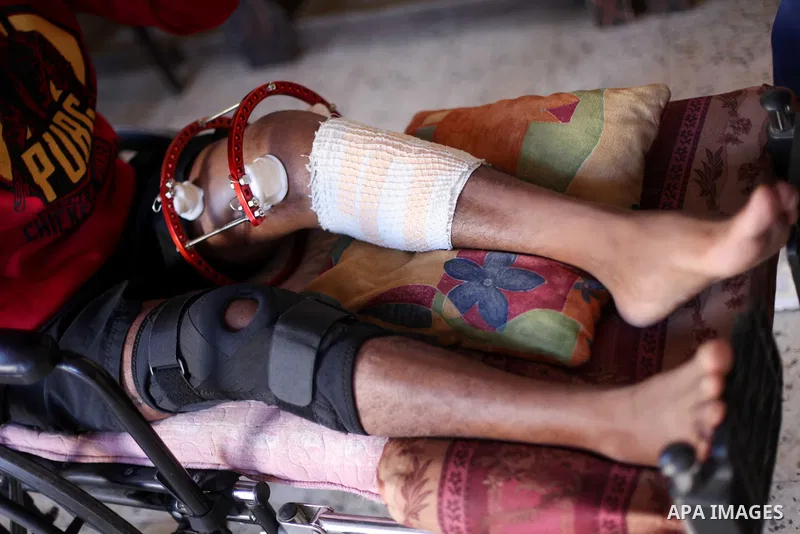 Palestinian boxer, Ahmed Abu Marahil, 20, who was shot by Israeli forces in his leg on June 2018, during a demonstration near a fence between Israel-Gaza border, attends a boxing lesson at his house in Gaza City on Decem...
