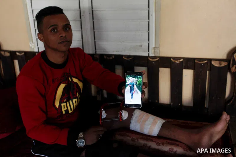 Palestinian boxer, Ahmed Abu Marahil, 20, who was shot by Israeli forces in his leg on June 2018, during a demonstration near a fence between Israel-Gaza border, displays his photos at phone at his house in Gaza City on...