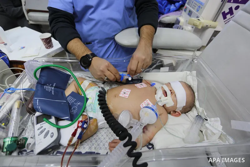 A Palestinian patient receives medical care at Al-Rantisi hospital in Gaza city on January 19, 2019. Gaza’s health ministry warned this week that some health services would be interrupted due to the ministry’s inability...
