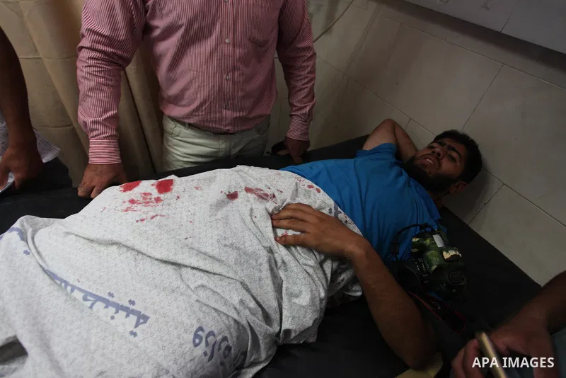 Palestinian photojournalist Mohammad al-Arbid, lays on a hospital bed as he receiving medical treatment after he was wounded by an Israeli security forces during a protest calling for end the Israeli blockade on Gaza Str...