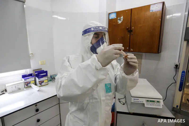 Palestinian Laboratory Medicine Specialist, tests vials of samples for coronavirus at Medical Laboratory, in Gaza city on March 15, 2020. For most people, the new coronavirus causes only mild or moderate symptoms. For so...