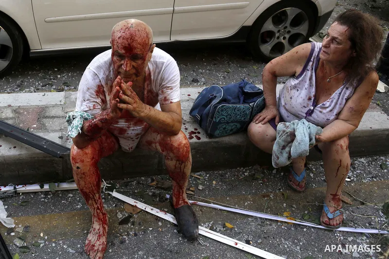 Wounded people sit on a street following an explosion in the Lebanese capital Beirut on August 4, 2020. Two huge explosion rocked the Lebanese capital Beirut, wounding dozens of people, shaking buildings and sending huge...