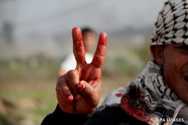 A Palestinian protester flashes a victory sign with his bloody hand during clashes with Israeli forces near the Nahal Oz border crossing with Israel, east of Gaza City on January 17, 2014. The Israeli army fired live rou...