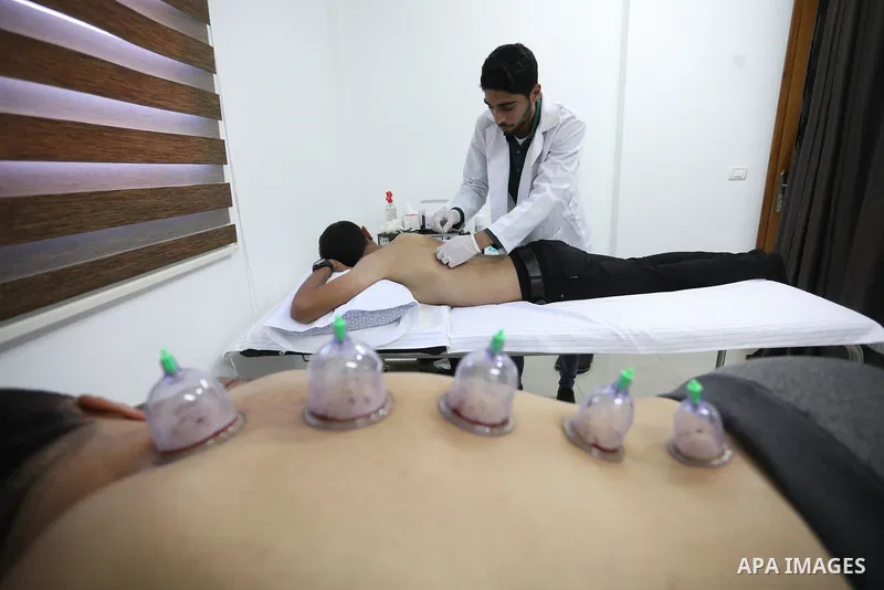 A Palestinian specialist performs Hajima, also knows as "wet cupping therapy", on a patient in Khan Younis in the southern of Gaza strip on September 26, 2021. Hijama is considered a traditional medical treatment in Isla...