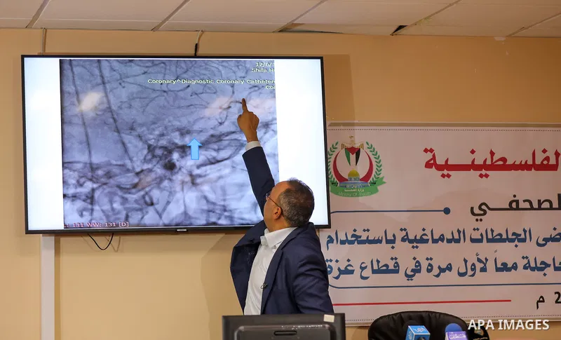 Mohamed Habib, a consultant cardiologist and catheter, speaks during a press conference about Gaza stroke program (GSP): Step 1, Diaganosis and treatment of acute ischemic stripe in hyper acute phase (first 6 hours), in...