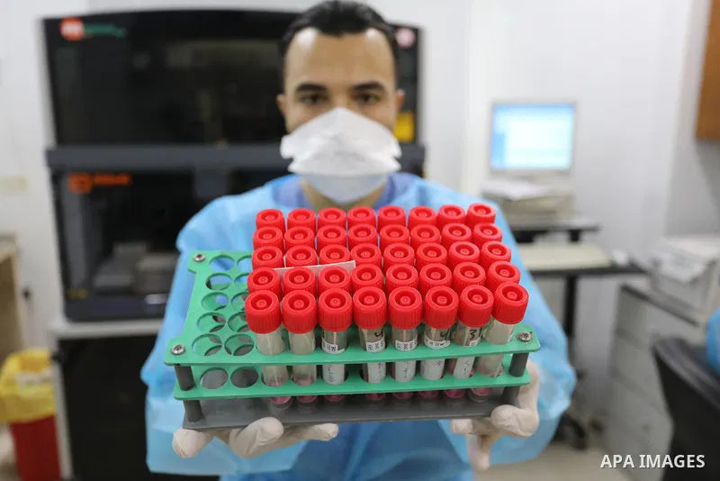 Palestinian Laboratory Medicine Specialist, tests vials of samples for coronavirus at Medical Laboratory, in Gaza city on November 28, 2021. In the past week a heavily mutated Covid variant has been identified, rapidly l...