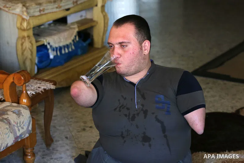 Disabled Palestinian man Youssef Abu Amira drinks water at his home in Gaza City January 25, 2021. Para-karate is the newest evolution of the martial art discipline that evolved in Japan. The new class of karate is an at...