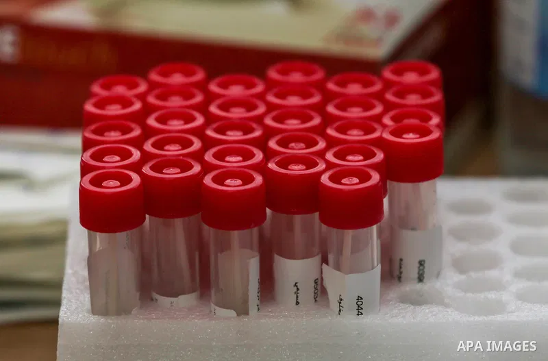A medic from the Palestinian Health Ministry takes swab samples from people to test for the coronavirus, in the West Bank city of Nablus on January 31, 2022. Daily Covid-19 cases in Palestine continued to rise and reache...