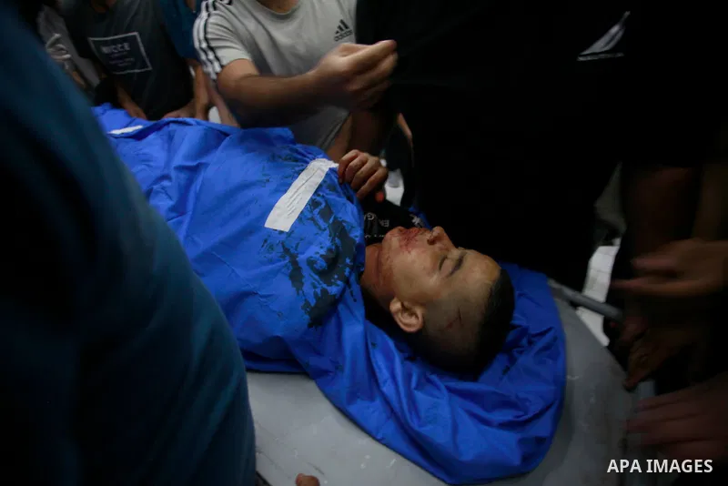 A Palestinian boy wounded in an Israeli army raid on Nur Shams refugee camp is brought to a hospital in Tulkarem, West Bank, on Thursday, Oct. 19, 2023. Photo by Mohammed Nasser\ APAimages