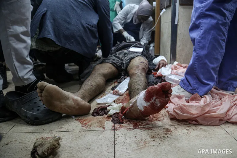 Injured Palestinians lies in a corridor at the Al-Aqsa Martyrs Hospital in Deir al-Balah in the central Gaza Strip, following Israel bombardment on March 31, 2024. photo by STR\ apaimages