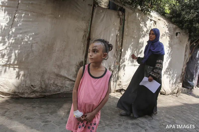 Sila Hoso, a 7-year-old Palestinian child who was seriously wounded in an Israeli attack on the town of Deir al-Balah is viewed in Deir al Balah, Gaza on August 13, 2024. Sila Hoso's treatment continues at Al-Aqsa Martyr...