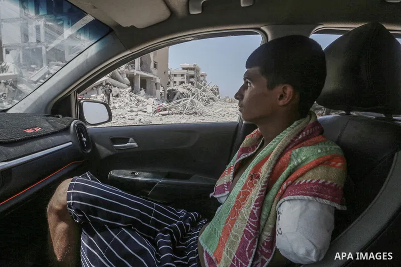 Palestinian teenager, Diaa Al-Adini, who was severely wounded in an Israeli army attack targeted an apartment on the al-Qastal Towers east of Deir al Balah, loses both of his arms in Deir al Balah, Gaza on September 02,...