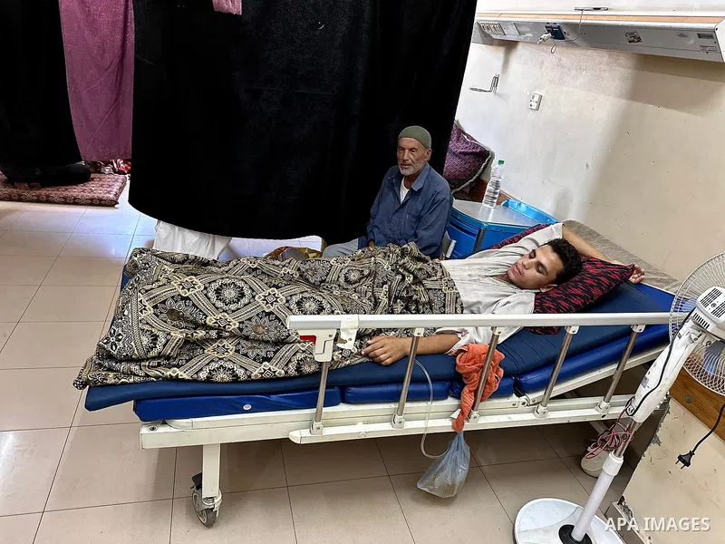 Palestinian Ibrahim Adly Abu Zeid (17 years old), displaced from Rafah and currently residing in Al-Mawasi, Khan Younis, is receiving medical care at Nasser Hospital in Khan Younis after being shot twice in his left leg...