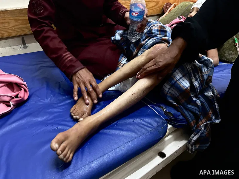Palestinian child Mais Abdel Aal, 10 years old and displaced to the Al-Mawasi area west of Khan Younis, is receiving medical care at Nasser Medical Complex after being shot by a drone while inside the tent sheltering her...