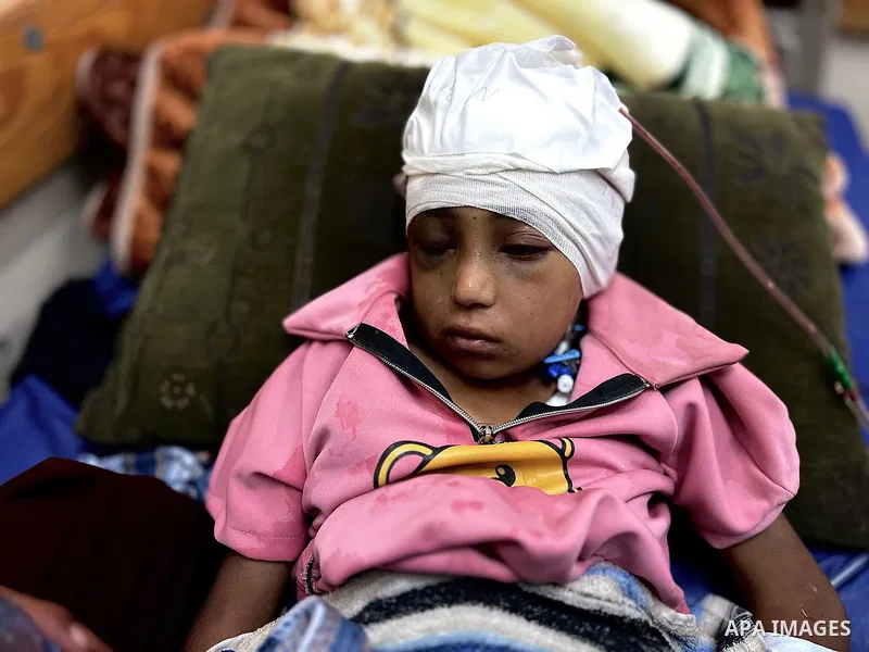 Palestinian child Mais Abdel Aal, 10 years old and displaced to the Al-Mawasi area west of Khan Younis, is receiving medical care at Nasser Medical Complex after being shot by a drone while inside the tent sheltering her...