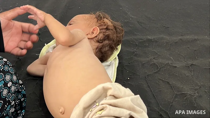 Palestinian children are receiving medical care at Al-Awda Hospital in Nuseirat Camp amid a severe shortage of food and medicine, further exacerbating the humanitarian crisis. The health conditions of the young patients...