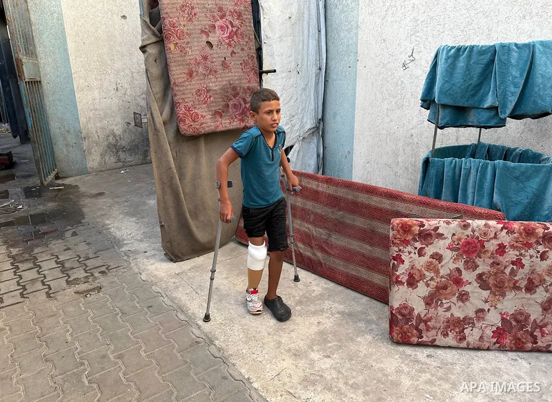 Palestinian child Rateb Abu Qleiq, who lost his mother and siblings and had his right leg amputated during the war, uses a prosthetic limb that helps him regain balance and move again in Deir al-Balah, central Gaza Strip...