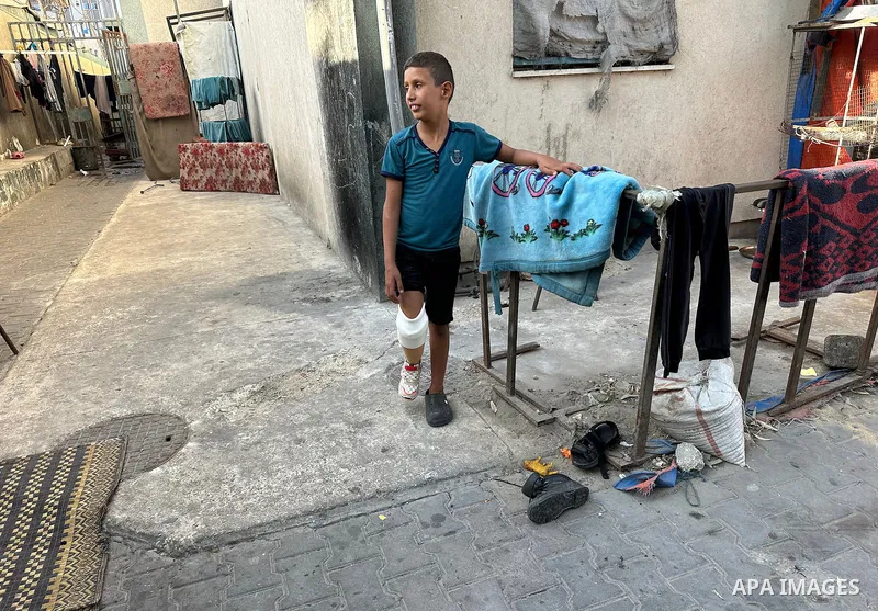 Palestinian child Rateb Abu Qleiq, who lost his mother and siblings and had his right leg amputated during the war, uses a prosthetic limb that helps him regain balance and move again in Deir al-Balah, central Gaza Strip...