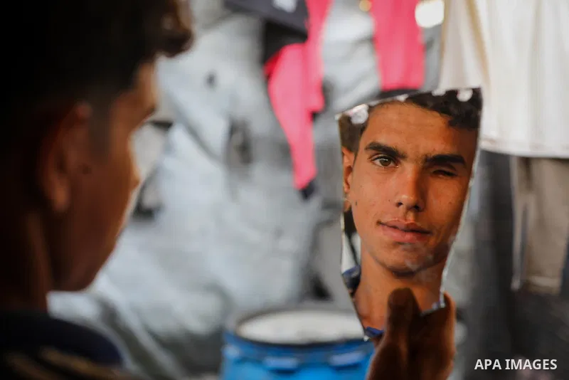 Palestinian teenager Khaled al-Shanbari, 18, who lost one of his eyes after being wounded in Israeli shelling, sits inside a displacement tent in Gaza City, on October 28, 2026. After undergoing several surgeries, al-Sha...