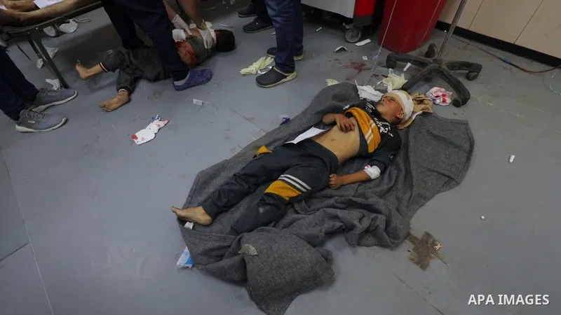 Palestinians wounded in Israeli air strikes on Gaza Strip are brought to al-Aqsa hospital in Deir el-Balah City, Gaza Strip