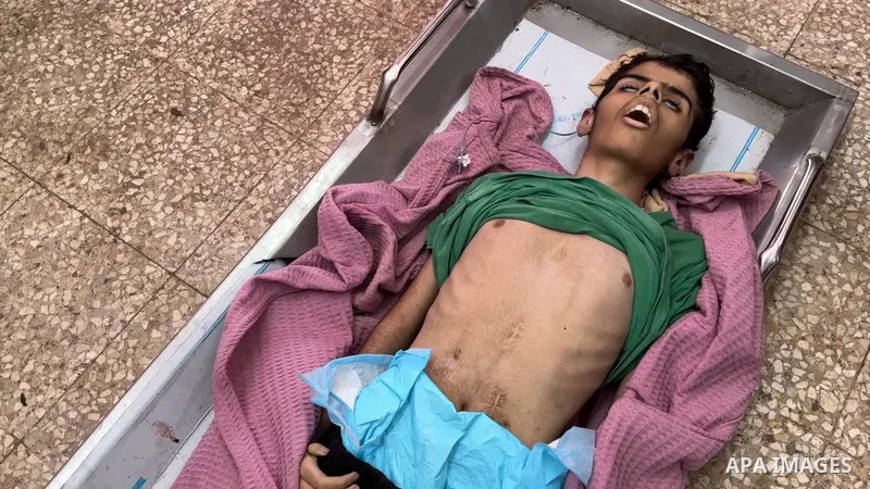Restrictions Summary: APA wire clients only Shortlist: APAwire - APA wire clients only, Khan Yunis- September 28, 2025. Palestinians mourn the body of a young Palestinian man who died from malnutrition and lack of medica...