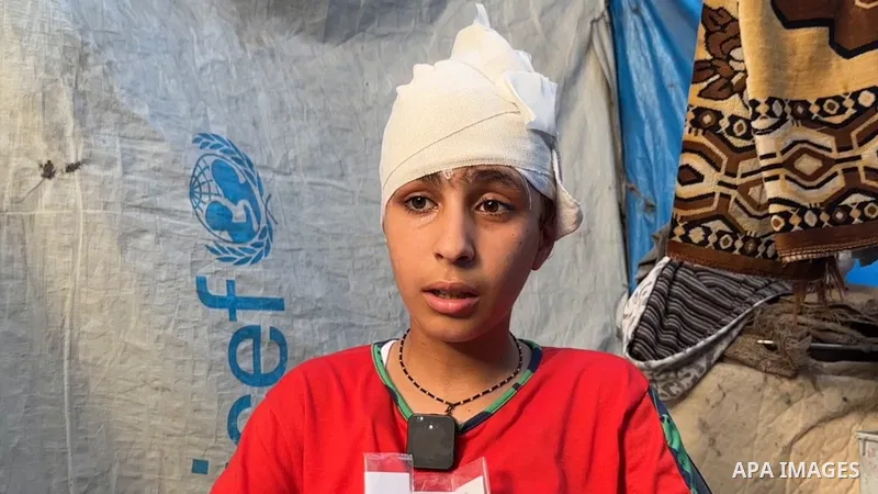Restrictions Summary: APA wire clients only Shortlist: APAwire - APA wire clients only, Gaza- July 5, 2025. Twelve-year-old Palestinian Hala Shukri Dahliz, who suffered a severe head injury in Israeli bombing resulting i...