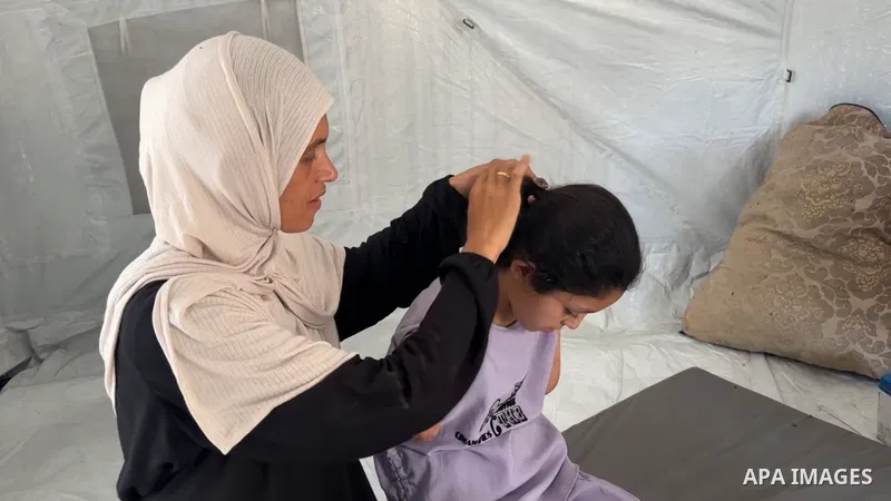 Restrictions Summary: APA wire clients only Shortlist: APAwire - APA wire clients only, Gaza- July 5, 2025. 10-year-old Palestinian Sarah Al-Barsh, who lost both of her arms in an Israeli attack, try to continue her dail...