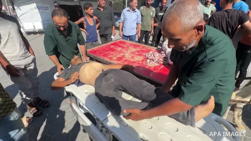 Restrictions Summary: APA wire clients only Shortlist: APAwire - APA wire clients only, Deir el-Balah- July 3, 2025. Plestinians transport the wounded and who lost their lives to the Al-Aqsa Martyrs hospital after an Isr...