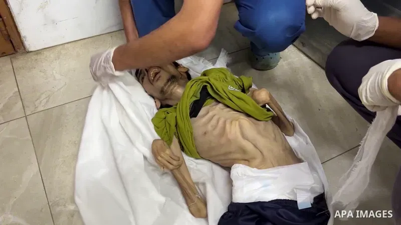 Restrictions Summary: APA wire clients only Shortlist: APAwire - APA wire clients only, Khan Yunis- July 1, 2025. Palestinians mourn 29-year-old Ayyoub Saber Abu Al-Hussain at Nasser Medical Hospital, after he died from...