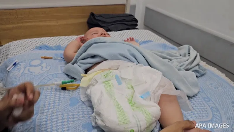 Restrictions Summary: APA wire clients only Shortlist: APAwire - APA wire clients only, Gaza City- July 1, 2025. The Palestinian infant Hani Ziyara (2 months old) is receiving medical care at "Patient's Friends Hospital"...