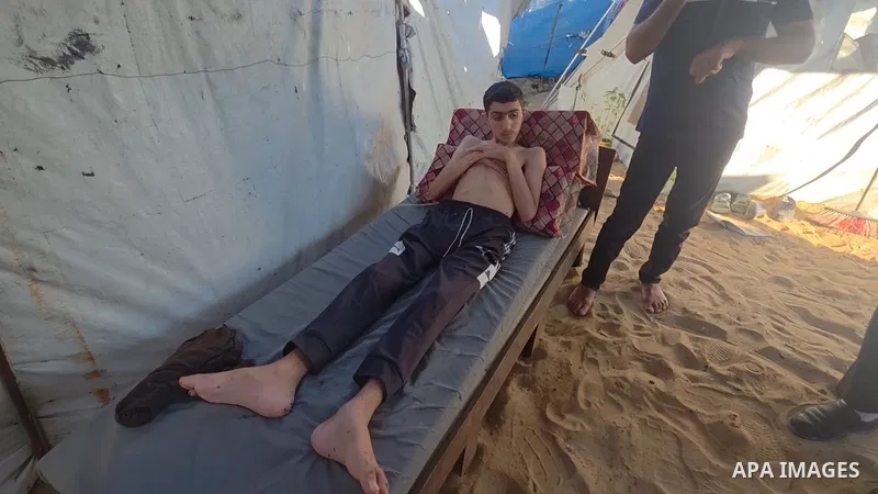 Restrictions Summary: APA wire clients only Shortlist: APAwire - APA wire clients only, Khan Younis- June 19, 2026. Palestinian boy Moatasem al-Ghalban, who was left partially paralyzed after being wounded by missile shr...