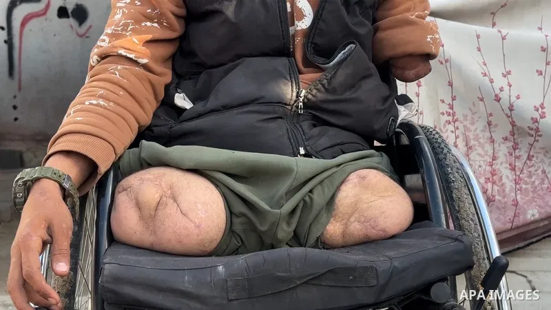 Restrictions Summary: APA wire clients only Shortlist: APAwire - APA wire clients only, Gaza - January 14, 2026. Raed Muhammad Maarouf, a 20-year-old Palestinian man who lost both legs and his left arm in an Israeli atta...